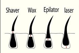 Which method removes hair the best?